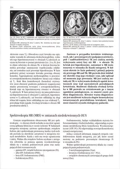 Neuroradiologia - J. Walecki - 314.jpg