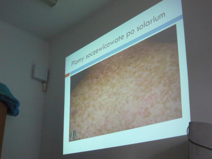 Dermatologia_seminarium_9_17042012 - P1100938m.JPG