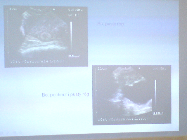 Podstawy ultrasonografii - DSC00572.JPG