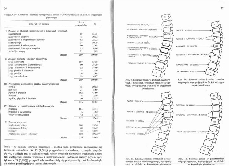 Choroba Scheuermanna - 0000013.jpg